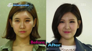 Illustration for article titled Depressing? Inspirational? Reverse Plastic Surgery Show Hits Korea
